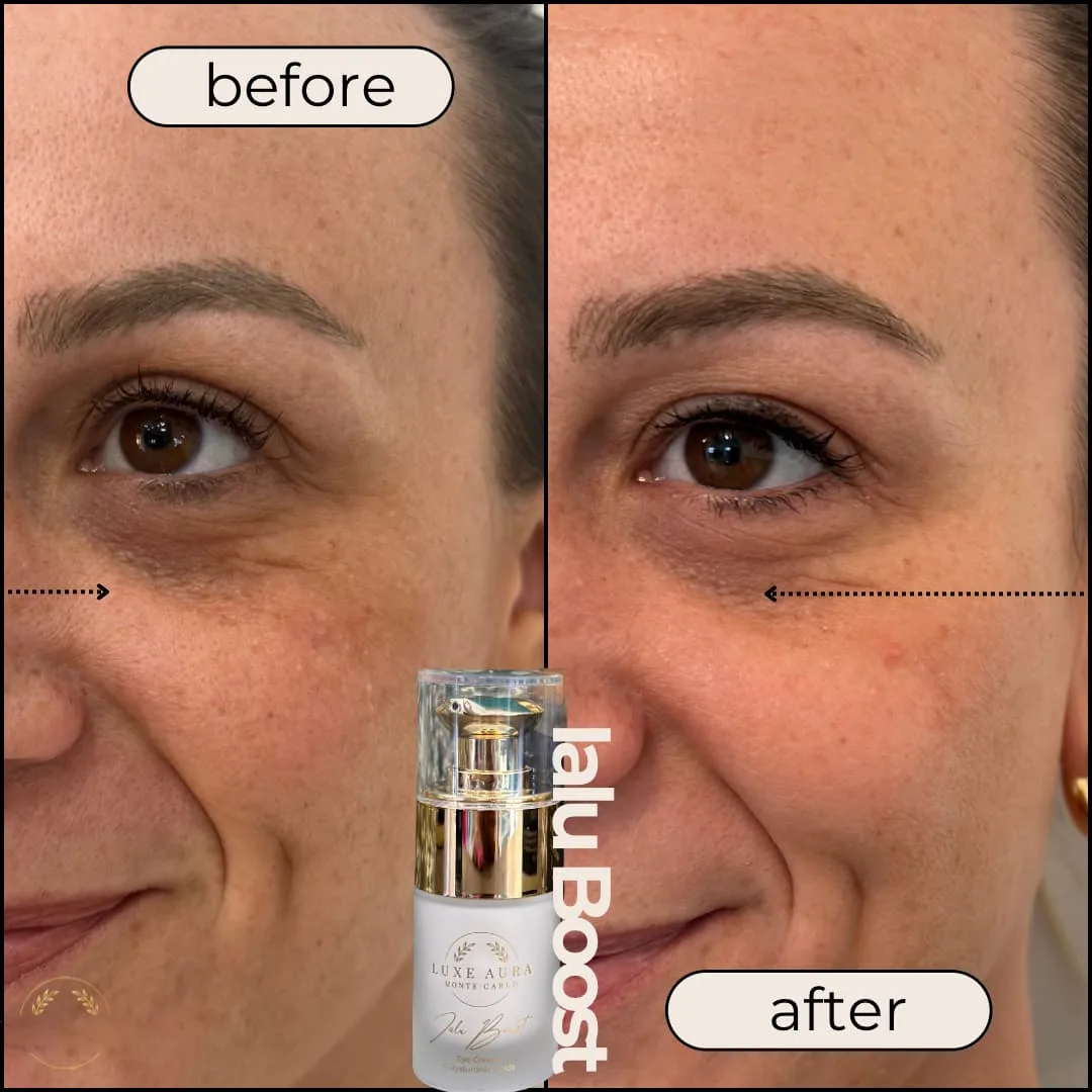 Ialu Boost – Image 6