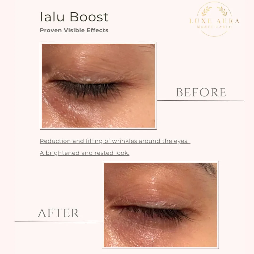 Ialu Boost – Image 4